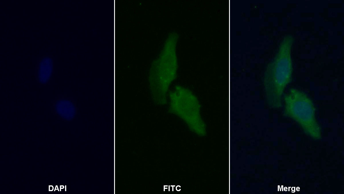 Polyclonal Antibody to Glycogen Phosphorylase, Muscle (PYGM)