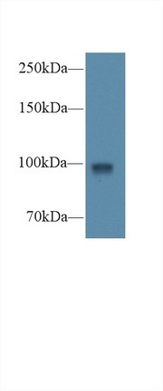 Polyclonal Antibody to Glycogen Phosphorylase, Liver (PYGL)