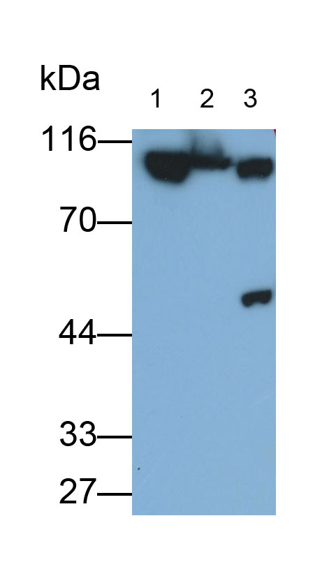 Polyclonal Antibody to Glycogen Phosphorylase, Liver (PYGL)