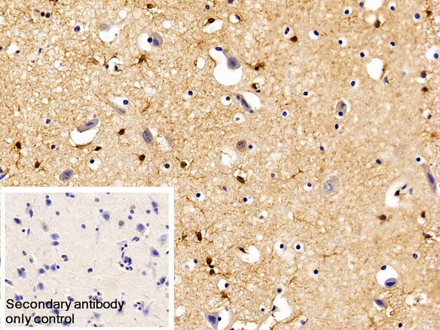 Polyclonal Antibody to Glycogen Phosphorylase, Liver (PYGL)