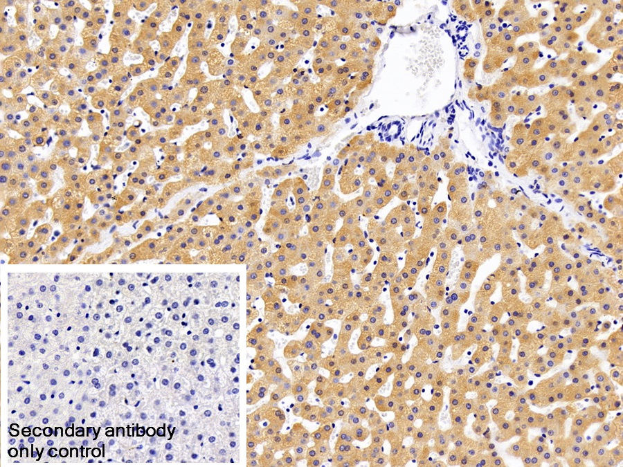 Polyclonal Antibody to Glycogen Phosphorylase, Liver (PYGL)