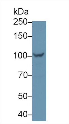 Polyclonal Antibody to Glycogen Phosphorylase, Liver (PYGL)