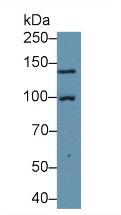 Polyclonal Antibody to Glycogen Phosphorylase, Liver (PYGL)