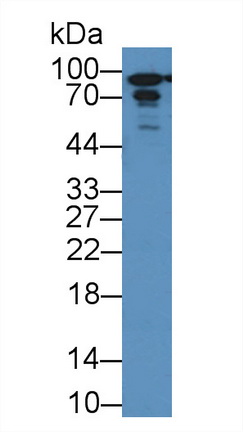 Polyclonal Antibody to Glycogen Phosphorylase, Liver (PYGL)