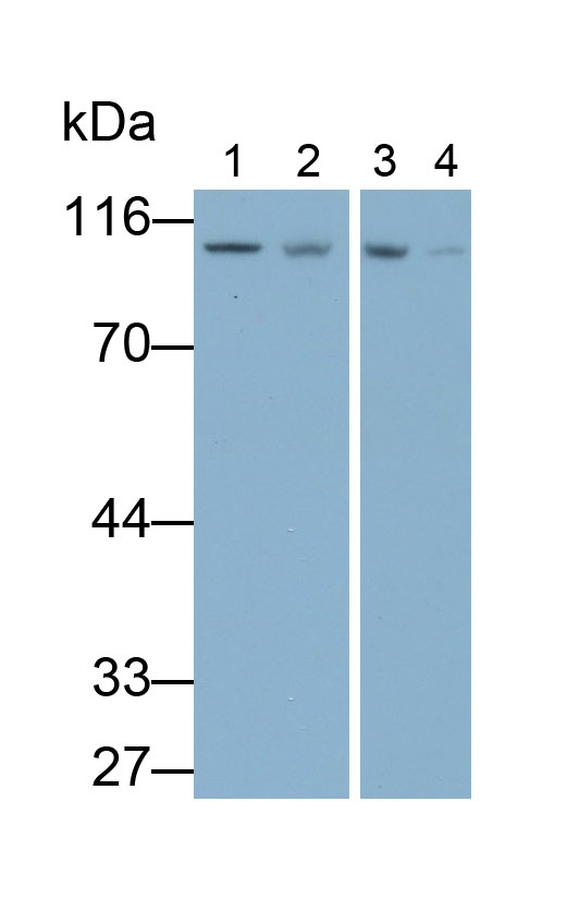 Polyclonal Antibody to Glycogen Phosphorylase, Liver (PYGL)