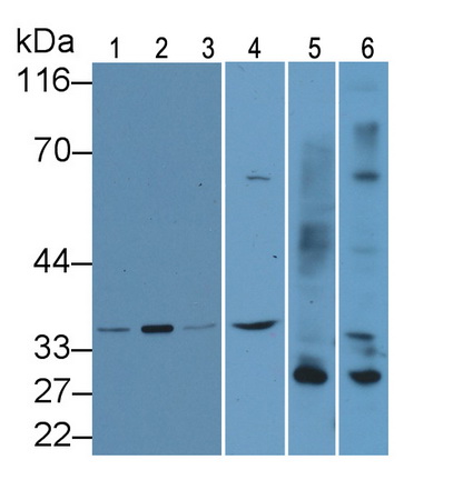 Polyclonal Antibody to Caspase 8 (CASP8)