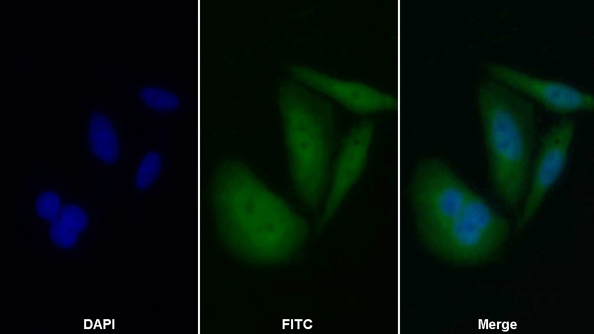 Polyclonal Antibody to Caspase 8 (CASP8)