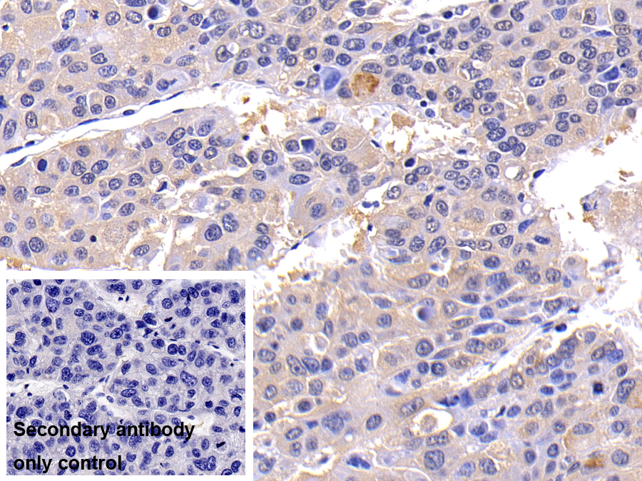 Polyclonal Antibody to Caspase 8 (CASP8)