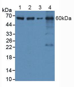 Polyclonal Antibody to Caspase 8 (CASP8)