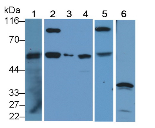 Polyclonal Antibody to Caspase 8 (CASP8)