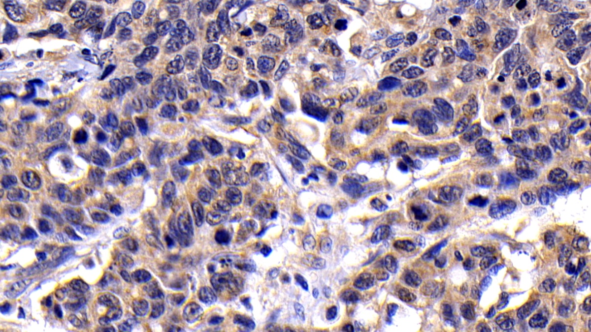 Polyclonal Antibody to Caspase 8 (CASP8)