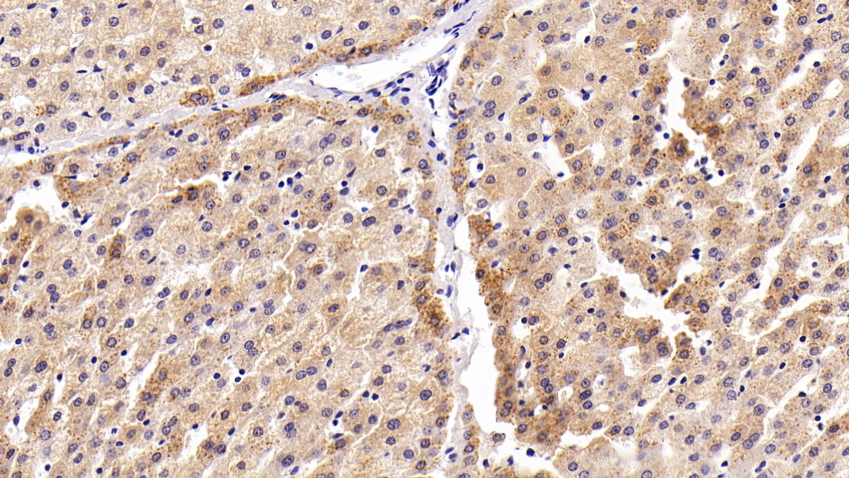 Polyclonal Antibody to Caspase 8 (CASP8)