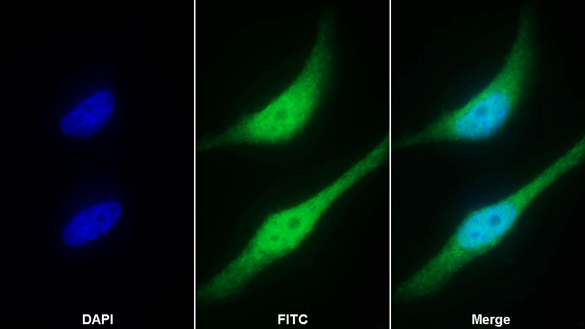 Polyclonal Antibody to Caspase 8 (CASP8)