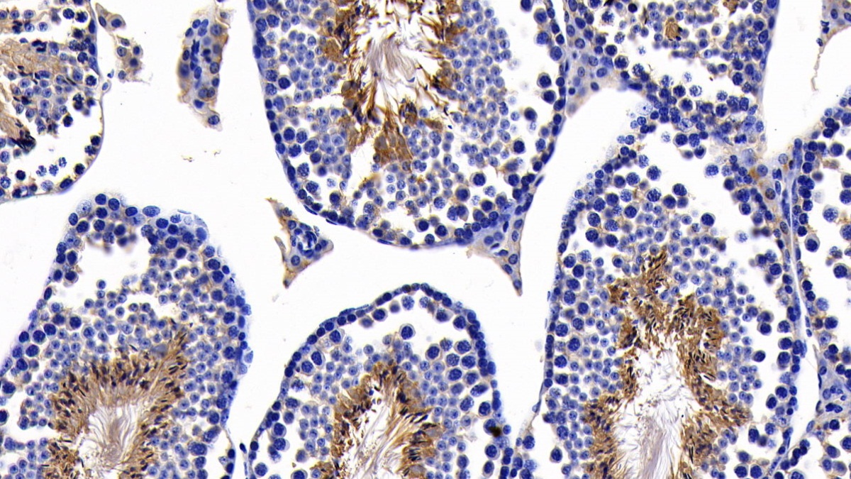 Polyclonal Antibody to Caspase 8 (CASP8)