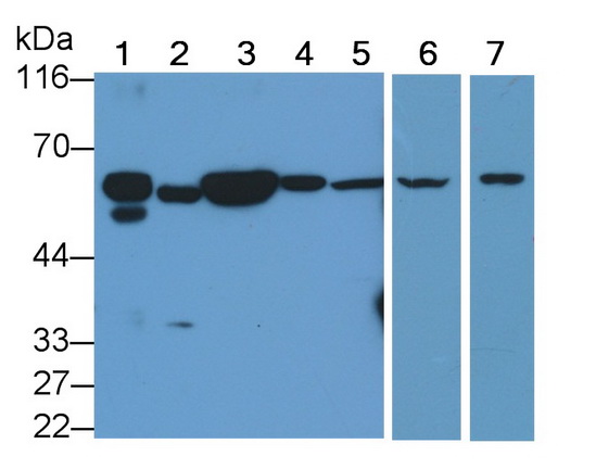 Polyclonal Antibody to Caspase 8 (CASP8)