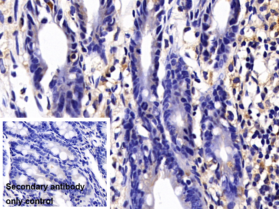 Polyclonal Antibody to Caspase 8 (CASP8)