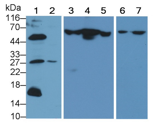 Polyclonal Antibody to Caspase 8 (CASP8)