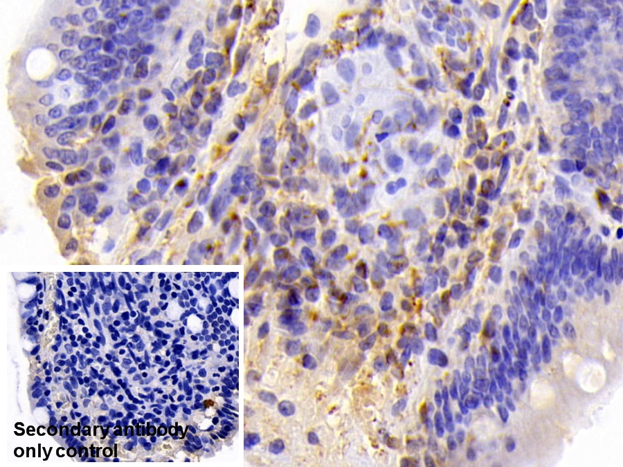 Polyclonal Antibody to Caspase 8 (CASP8)