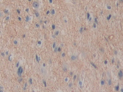 Polyclonal Antibody to Aminopeptidase A (ENPEP)