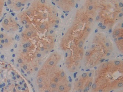 Polyclonal Antibody to Aminopeptidase A (ENPEP)