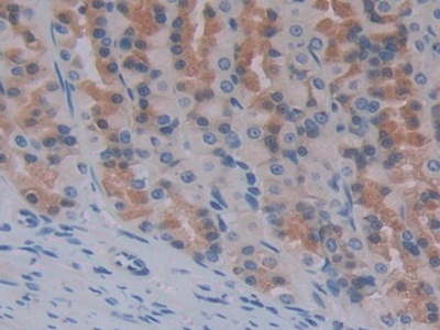 Polyclonal Antibody to Aminopeptidase A (ENPEP)