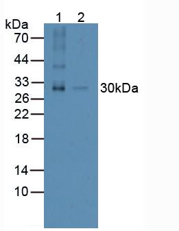 Polyclonal Antibody to Receptor Activator Of Nuclear Factor Kappa B Ligand (RANkL)