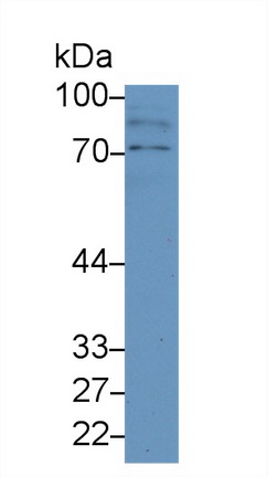 Polyclonal Antibody to Mannose Associated Serine Protease 2 (MASP2)