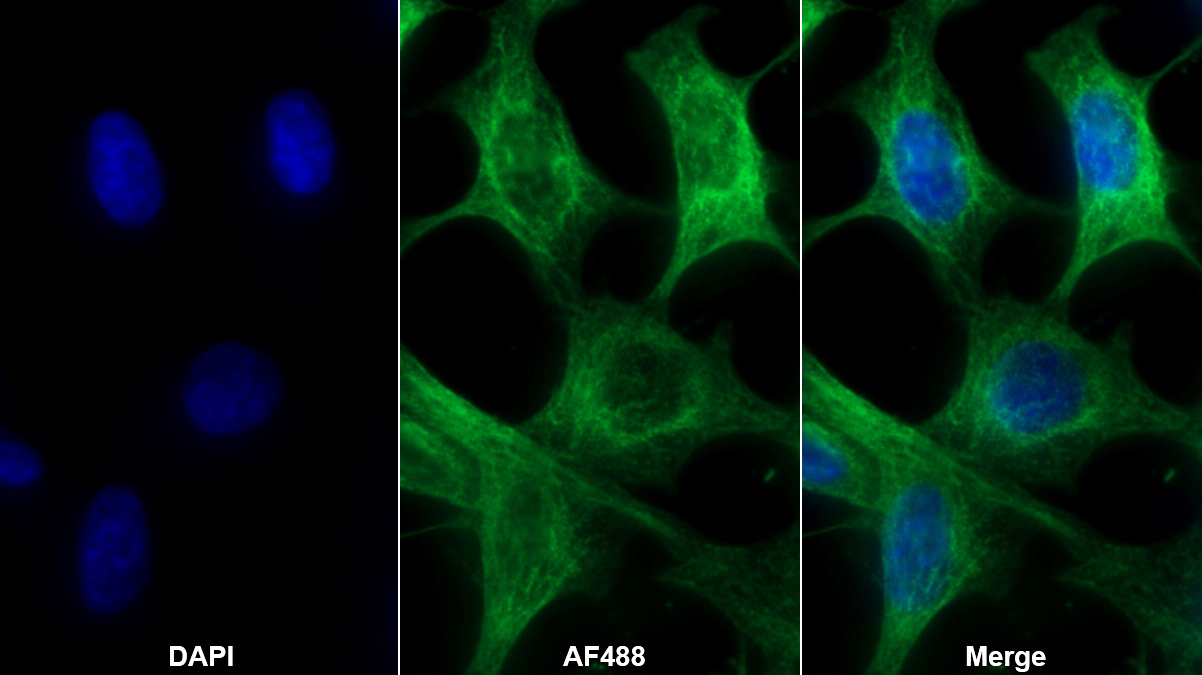 Polyclonal Antibody to Mannose Associated Serine Protease 2 (MASP2)