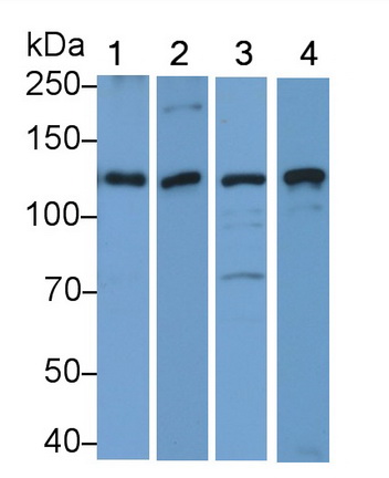 Polyclonal Antibody to Complement Component 3 (C3)