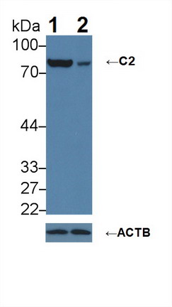 Polyclonal Antibody to Complement Component 2 (C2)