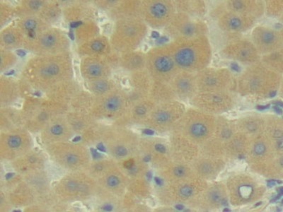 Polyclonal Antibody to Complement Component 2 (C2)