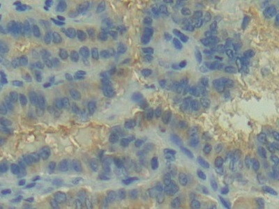 Polyclonal Antibody to Complement Component 2 (C2)