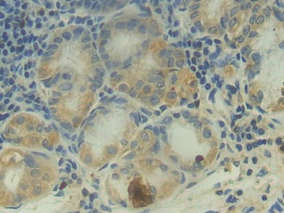 Polyclonal Antibody to Complement Component 2 (C2)