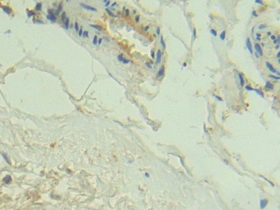 Polyclonal Antibody to Complement Component 2 (C2)