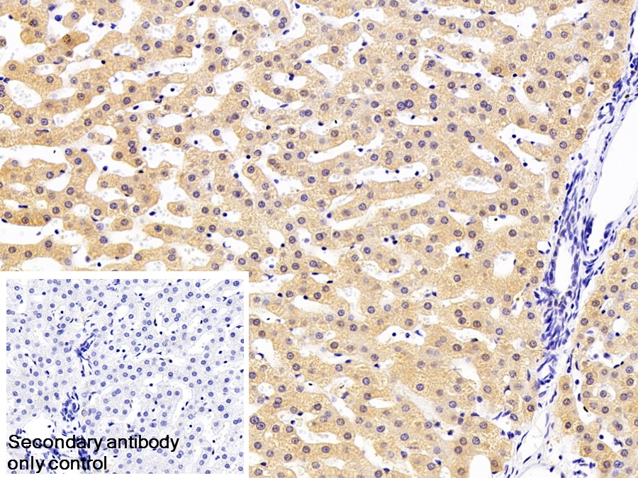 Polyclonal Antibody to Complement Component 2 (C2)