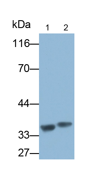 Polyclonal Antibody to Amyloid Beta Peptide 1-40 (Ab1-40)