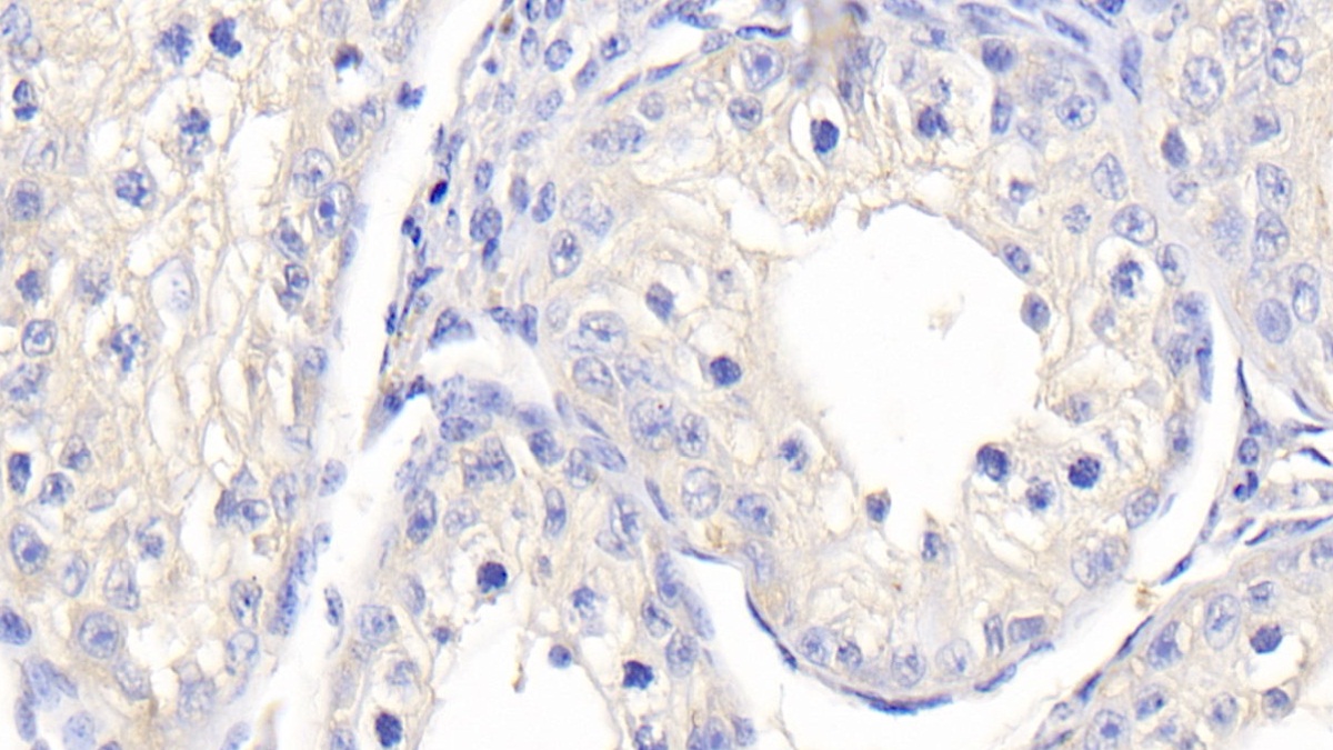 Polyclonal Antibody to Endothelial NOS (eNOS)