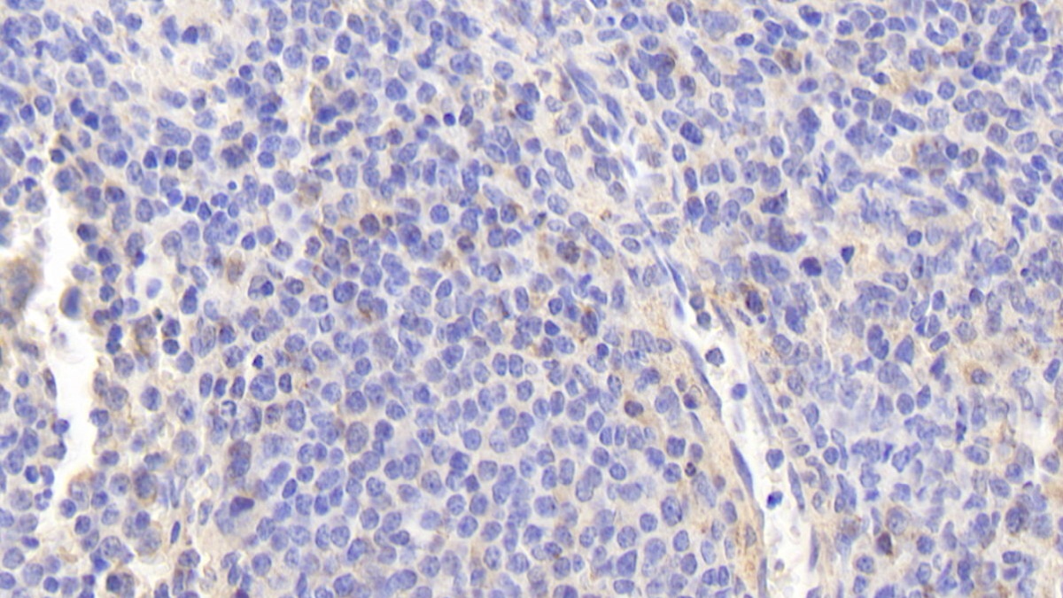 Polyclonal Antibody to Endothelial NOS (eNOS)