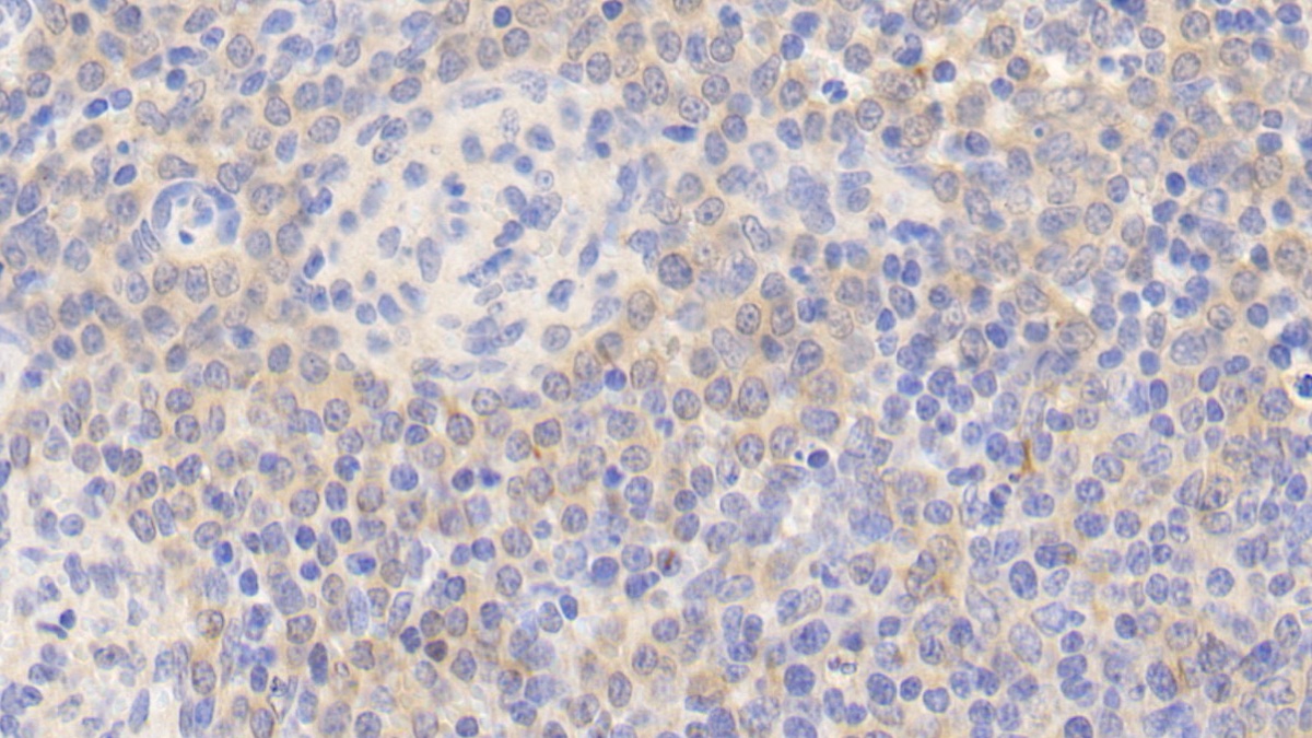 Polyclonal Antibody to Endothelial NOS (eNOS)