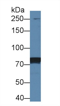 Polyclonal Antibody to Anaplastic Lymphoma Kinase (ALK)