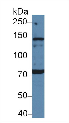 Polyclonal Antibody to Anaplastic Lymphoma Kinase (ALK)