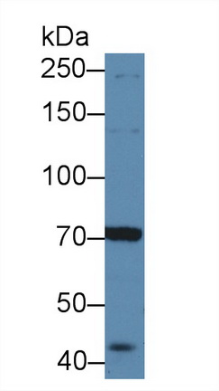 Polyclonal Antibody to Anaplastic Lymphoma Kinase (ALK)