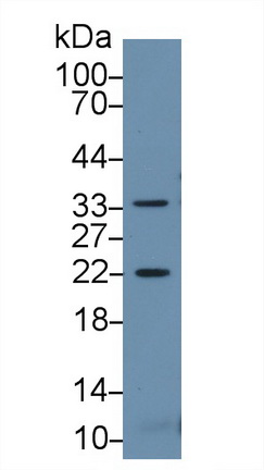 Polyclonal Antibody to Heat Shock Protein Beta 2 (HSPb2)