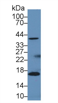 Polyclonal Antibody to Heat Shock Protein 40 (HSP40)