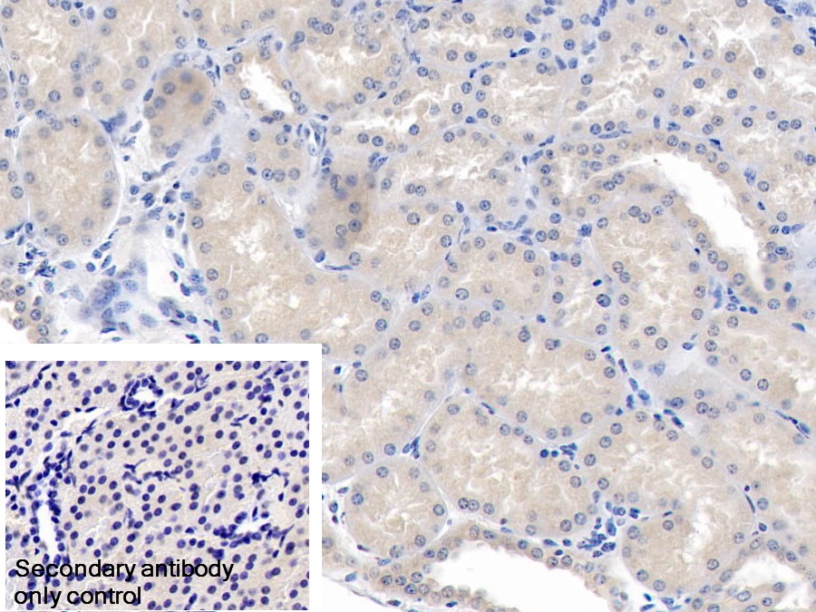 Polyclonal Antibody to Angiopoietin-3 (ANG-3)