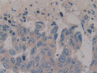 Polyclonal Antibody to Neuropeptide Y (NPY)