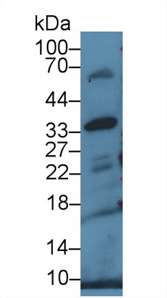 Polyclonal Antibody to Cluster Of Differentiation 200 (CD200)