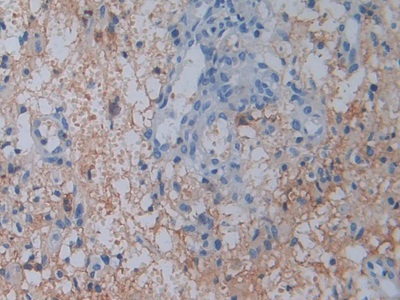 Polyclonal Antibody to Cluster Of Differentiation 26 (CD26)