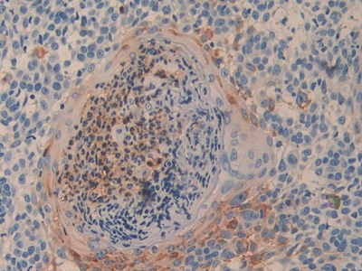 Polyclonal Antibody to Cluster Of Differentiation 26 (CD26)