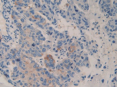 Polyclonal Antibody to Cluster Of Differentiation 26 (CD26)